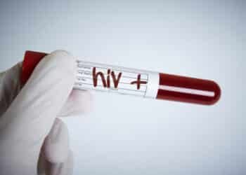 Laboratory Request, Hiv Test, Hiv Positive