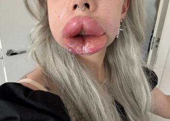 Foto: Reprodução/Instagram.