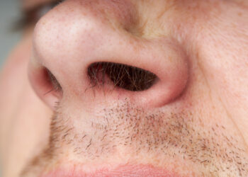 Andrii Atanov/istock.