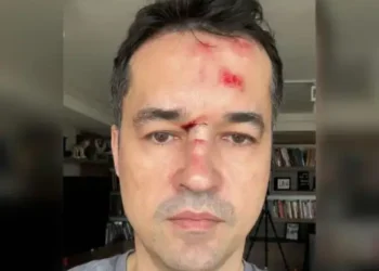 Reprodução.