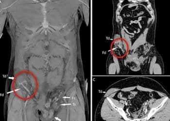 Reprodução/BMJ Case Reports