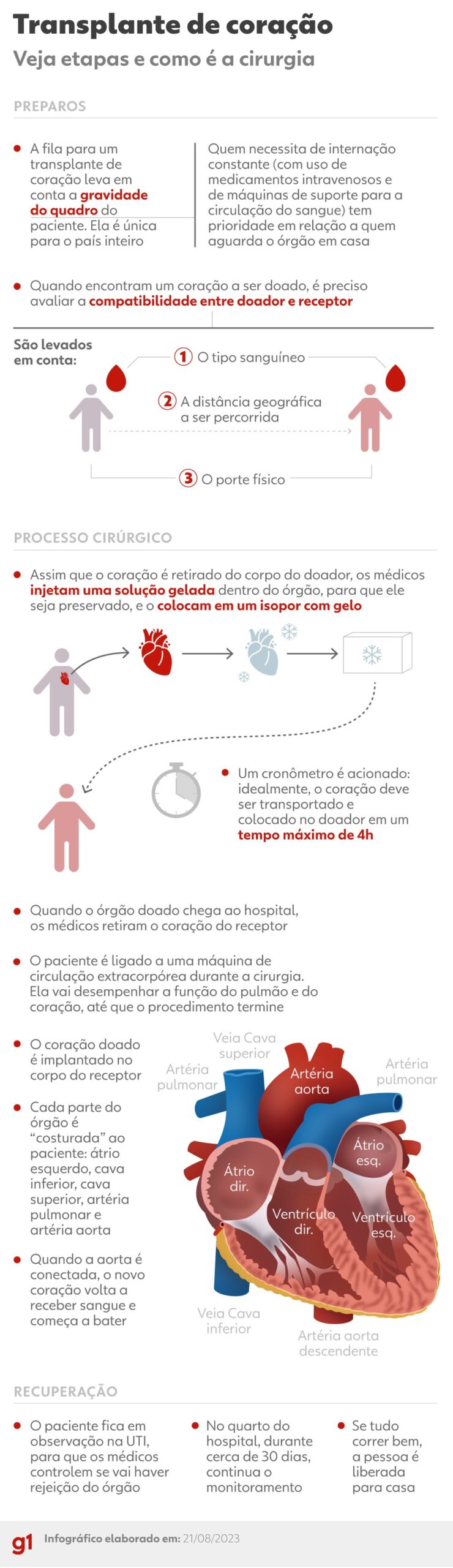 Veja as etapas do transplante de coração — Foto: Arte/g1