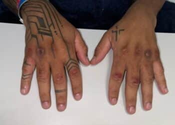 Material cedido ao Metrópoles