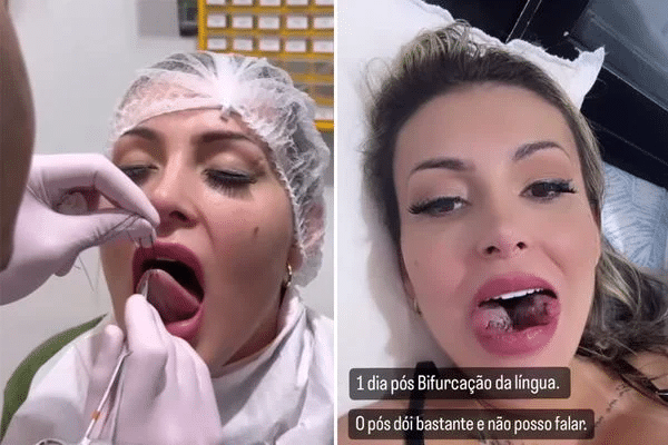 Imagens Fortes: Andressa Urach aparece com língua partida ao meio e surpreende seguidores; VEJA VÍDEO