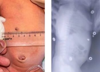 Foto: Reprodução The Sun