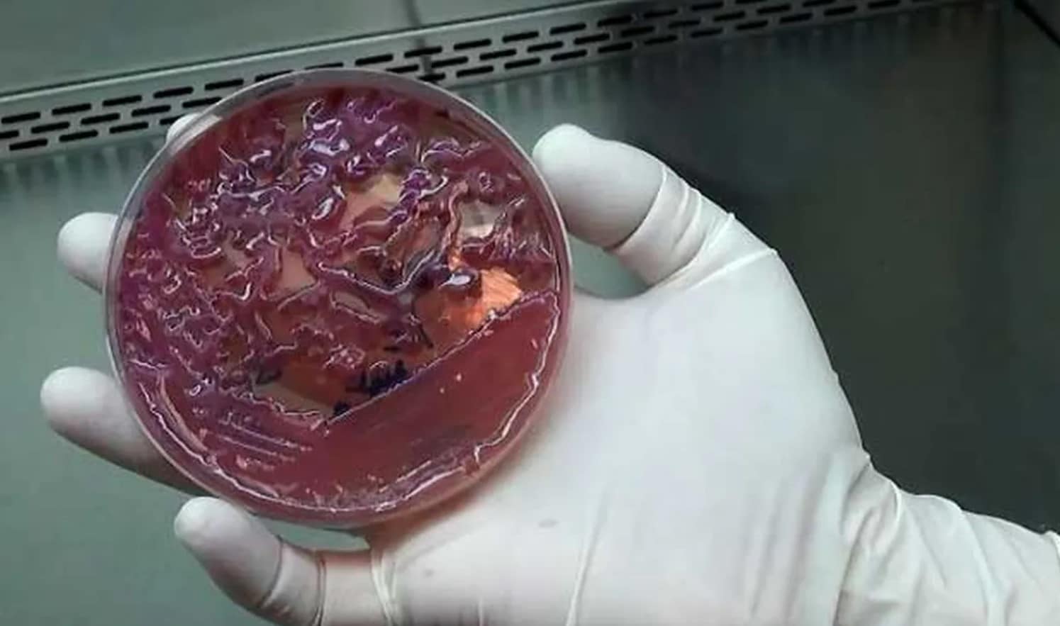 Alerta global: Superbacterias con potencial de causar pandemia ya han llegado a 16 países