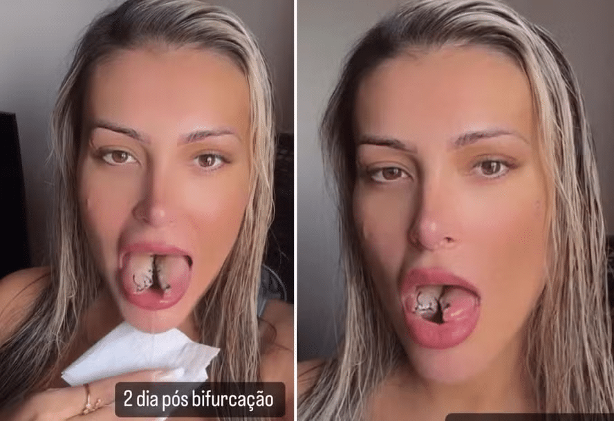 Internação psiquiátrica é pedida à Andressa Urach após ela revelar cirurgia polêmica