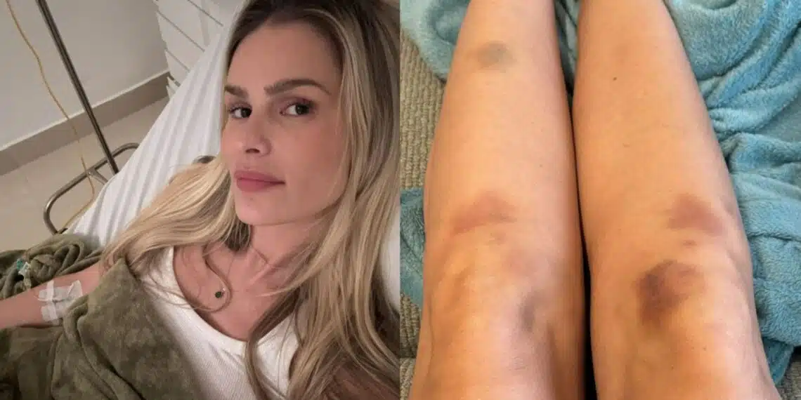 Yasmin Brunet é hospitalizada para tratar doença crônica; Entenda