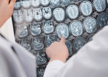 Estudo revela a idade em que o cérebro alcança seu auge