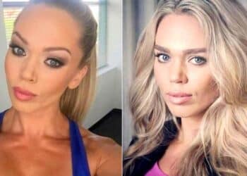 Ex-modelo choca ao surgir irreconhecível e sem nada nas ruas