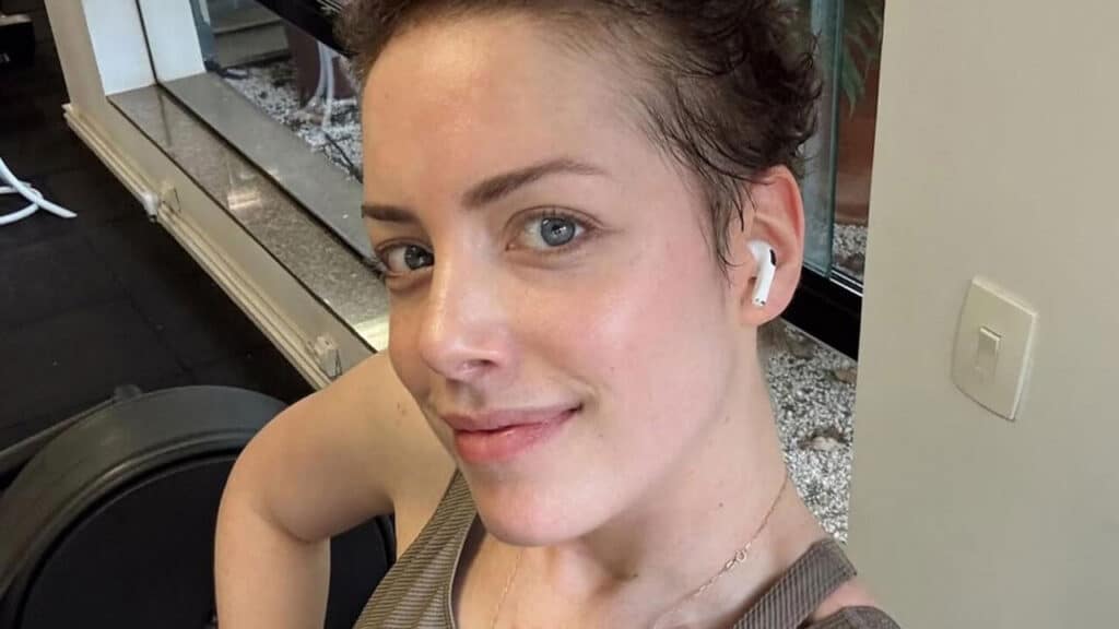 Fabiana Justus quebra o silêncio e revela estado de saúde após transplante de medula