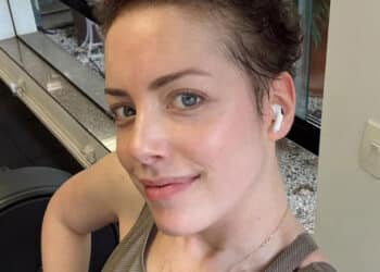 Fabiana Justus quebra o silêncio e revela estado de saúde após transplante de medula