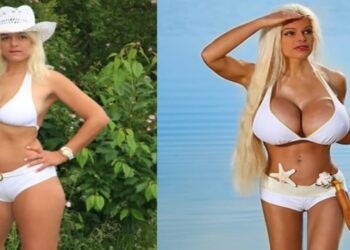 Mulher alemã realiza procedimento para transformar sua pele em 'negra': "Transracial"