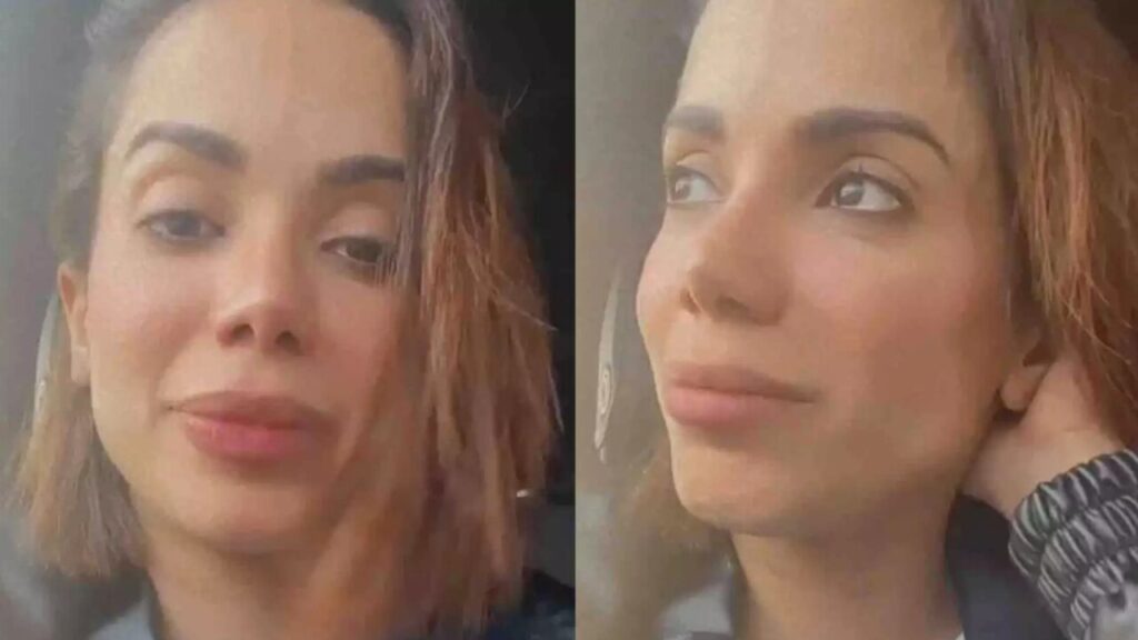 Anitta ressurge irreconhecível após sumiço e choca fãs com 'novo rosto'