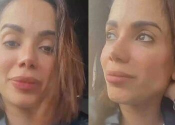 Anitta quebra o silêncio sobre 'briga' com gigante farmacêutica