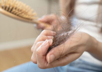 Risco de queda de cabelo associado ao uso de Semaglutida