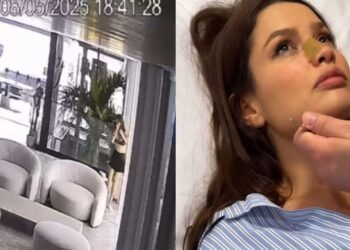 Juliette sofre acidente doméstico e vai parar no hospital; veja