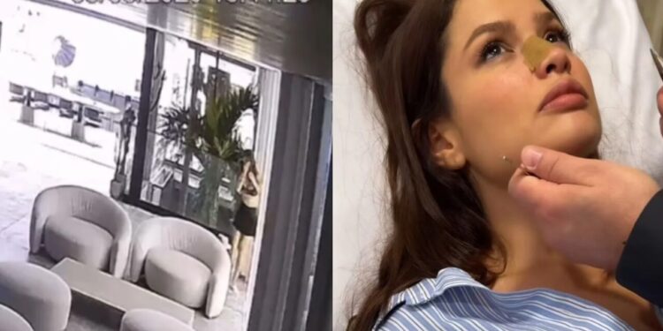 Juliette sofre acidente doméstico e vai parar no hospital; veja
