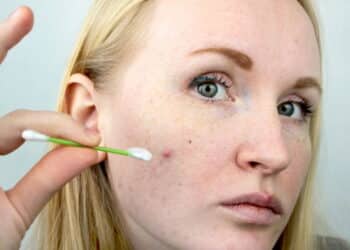 Dermatologistas estão recomendando isso e o motivo vai te surpreender!