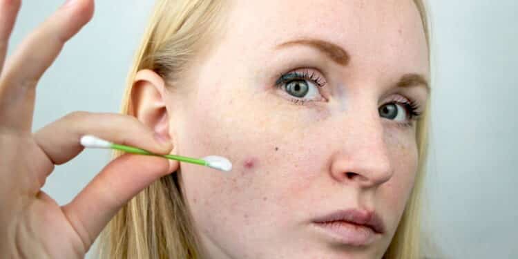 Dermatologistas estão recomendando isso e o motivo vai te surpreender!