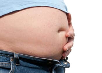 Especialistas dizem que esses alimentos comuns podem inchar sua barriga