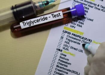 Triglyceride (Créditos: depositphotos.com / olanstock)
