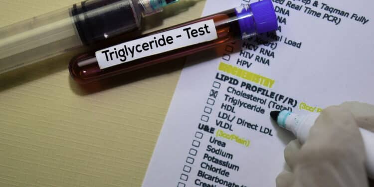 Triglyceride (Créditos: depositphotos.com / olanstock)