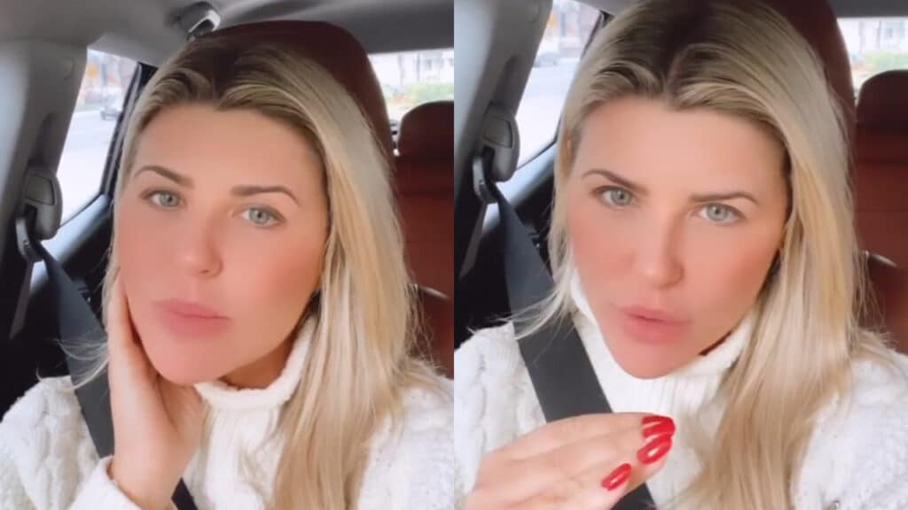 Ex-BBB Íris Stefanelli aparece com hematomas no rosto e gera preocupação nos fãs