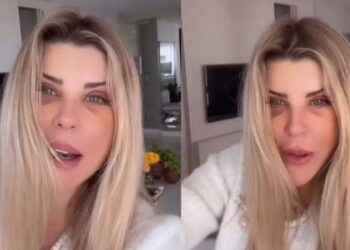 Ex-BBB Íris Stefanelli aparece com hematomas no rosto e gera preocupação nos fãs