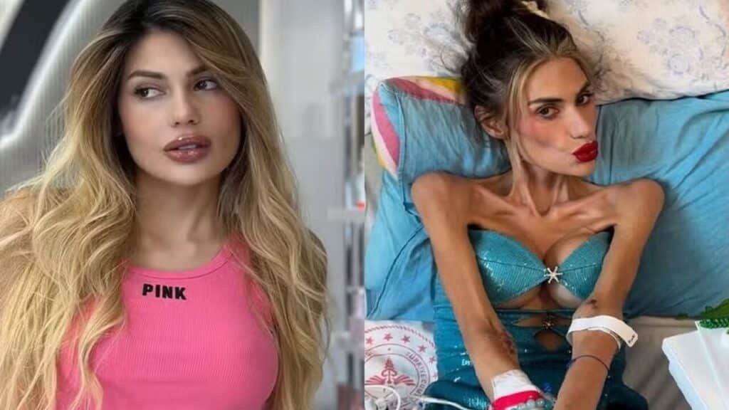 Influencer de 30 anos morre pesando apenas 22 kg e choca seguidores; entenda o caso