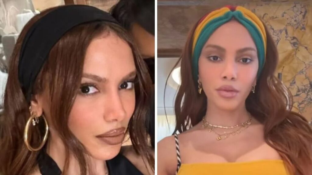 Anitta quebra o silêncio após críticas sobre aparência “estranha”