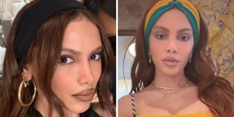 Anitta quebra o silêncio sobre mudança no rosto e nega cirurgia malsucedida