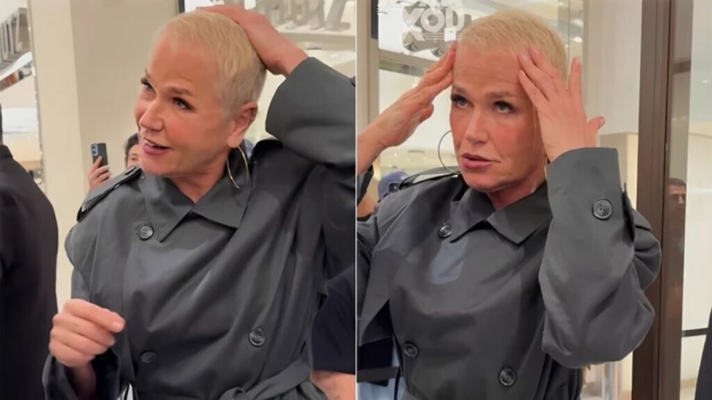 Após implante capilar, Xuxa revela resultado e surpreende fãs