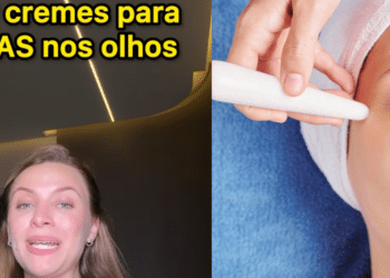 "TOP cremes para rugas nos olhos " segundo a dermato Cintia Martins