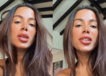 Anitta quebra o silêncio após críticas sobre aparência “estranha”