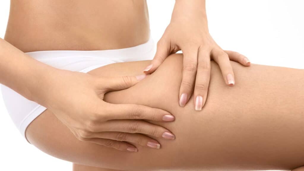 Adeus celulite com desconforto: Novas faixas frias que desincham e modelam sem sofrimento!