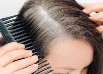 Adeus cabelos brancos! Esse é o melhor shampoo tonalizante para escurecer a raiz em casa!