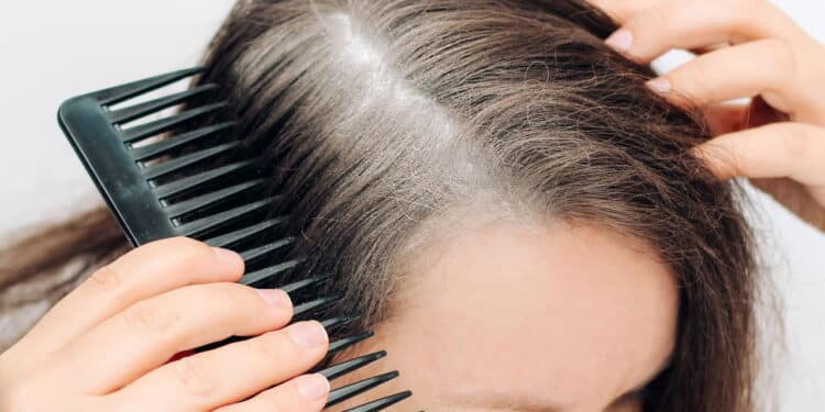 Adeus cabelos brancos! Esse é o melhor shampoo tonalizante para escurecer a raiz em casa!