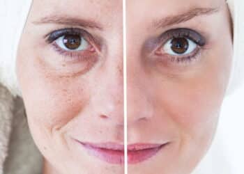 Máscara facial simples com três ingredientes reduz rugas em mulheres em poucos minutos