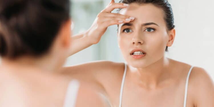 Adeus pele seca: veja a solução fácil e barata para o ressecamento no inverno