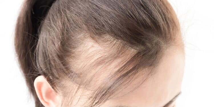 Mulher com cabelo fino. Créditos: depositphotos.com / mraoraor