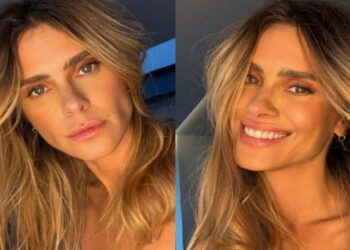 O truque revelado por Carolina Dieckmann que deixa a pele jovem e radiante