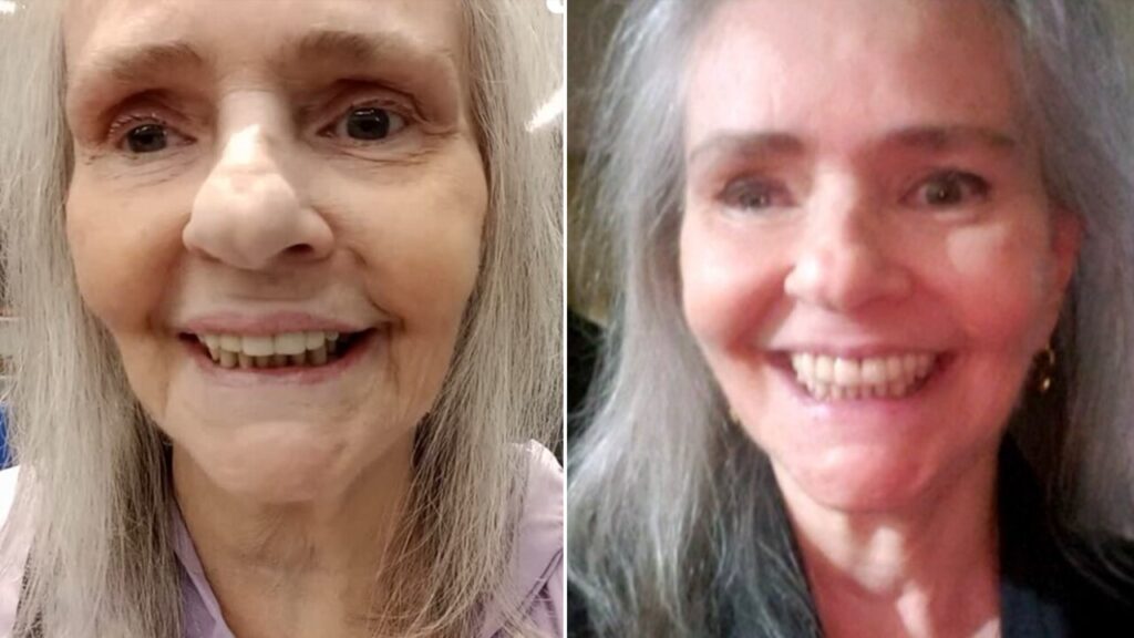 Causa da morte da cantora Angela Ro Ro é revelada