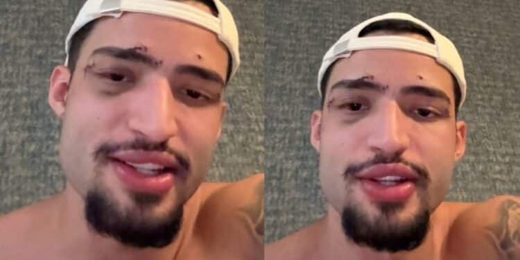 Influenciador brasileiro que ficou em coma na Grécia quebra silêncio sobre o caso