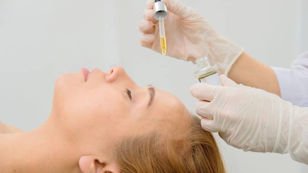O segredo dos ácidos que resolvem a pele com acne e oleosidade já nas primeiras semanas