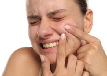 A melhor rotina de skincare para adolescentes com pele oleosa