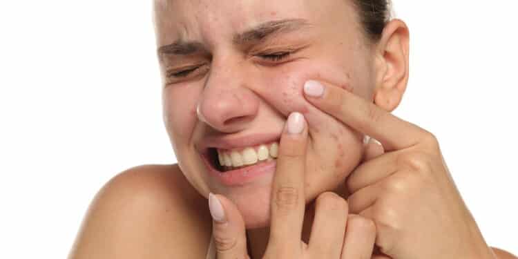 A melhor rotina de skincare para adolescentes com pele oleosa