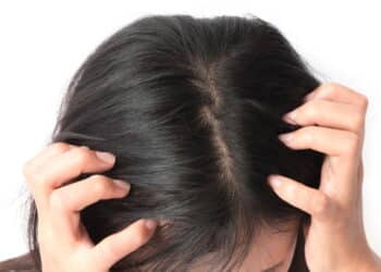 Top 10 shampoos para caspa que resolvem o problema nas primeiras aplicações