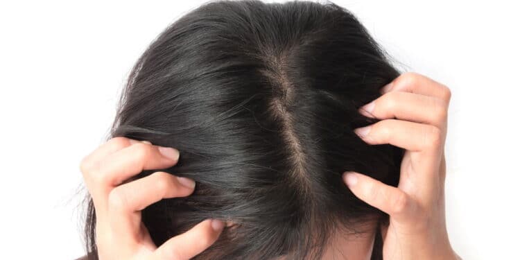 Top 10 shampoos para caspa que resolvem o problema nas primeiras aplicações