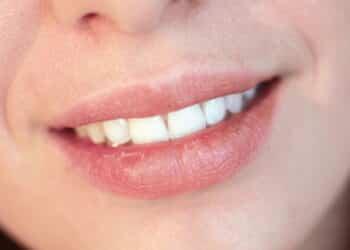 Soluções baratas para quem sofre com lábios sempre ressecados